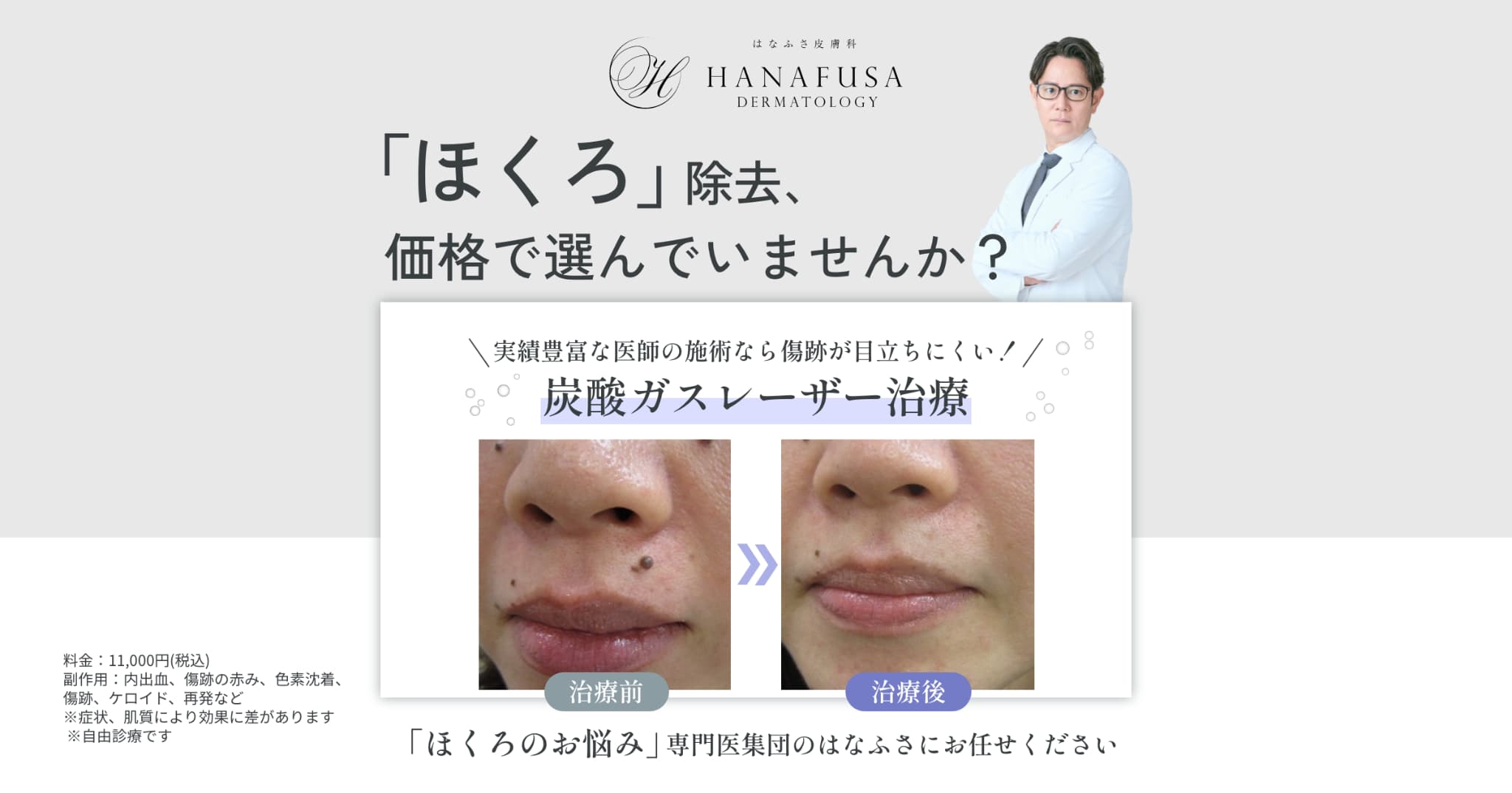 ほくろ除去・治療は実績豊富な【はなふさ皮膚科へ】